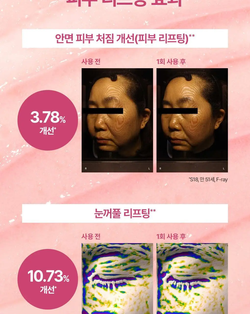 [촉촉광채/올인원멀티케어] 가히 멀티밤 9g 상세페이지 16